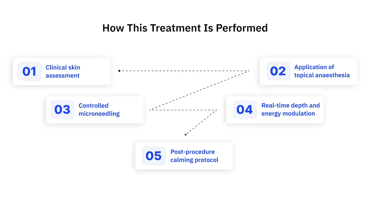 How This Treatment Is Performed