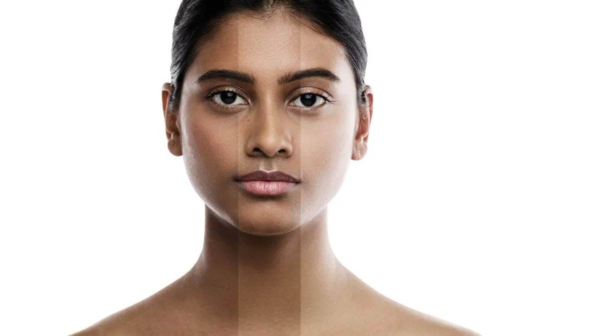  Uneven Skin Texture and Tone