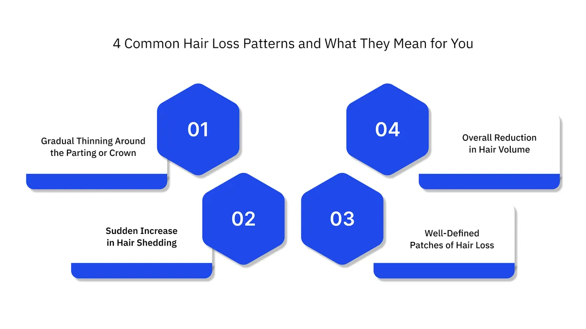 4 Common Hair Loss Patterns and What They Mean for You