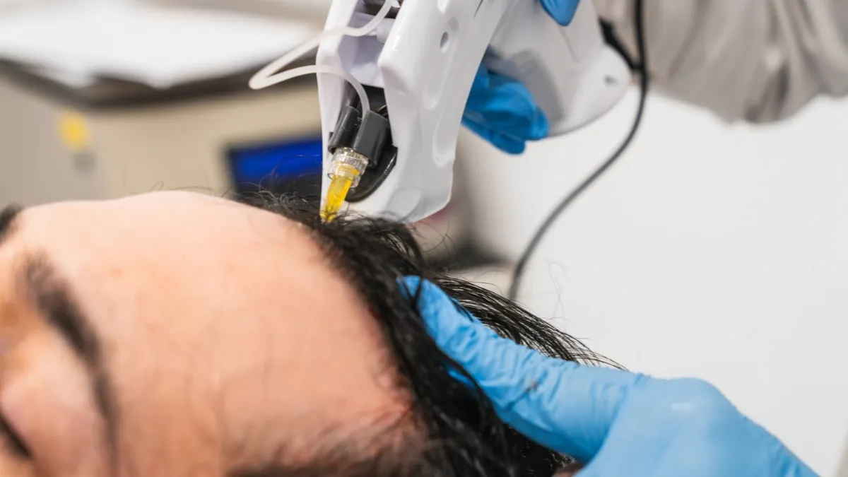 5 Trusted PRP Hair Treatment Clinics in Alwarpet, Chennai