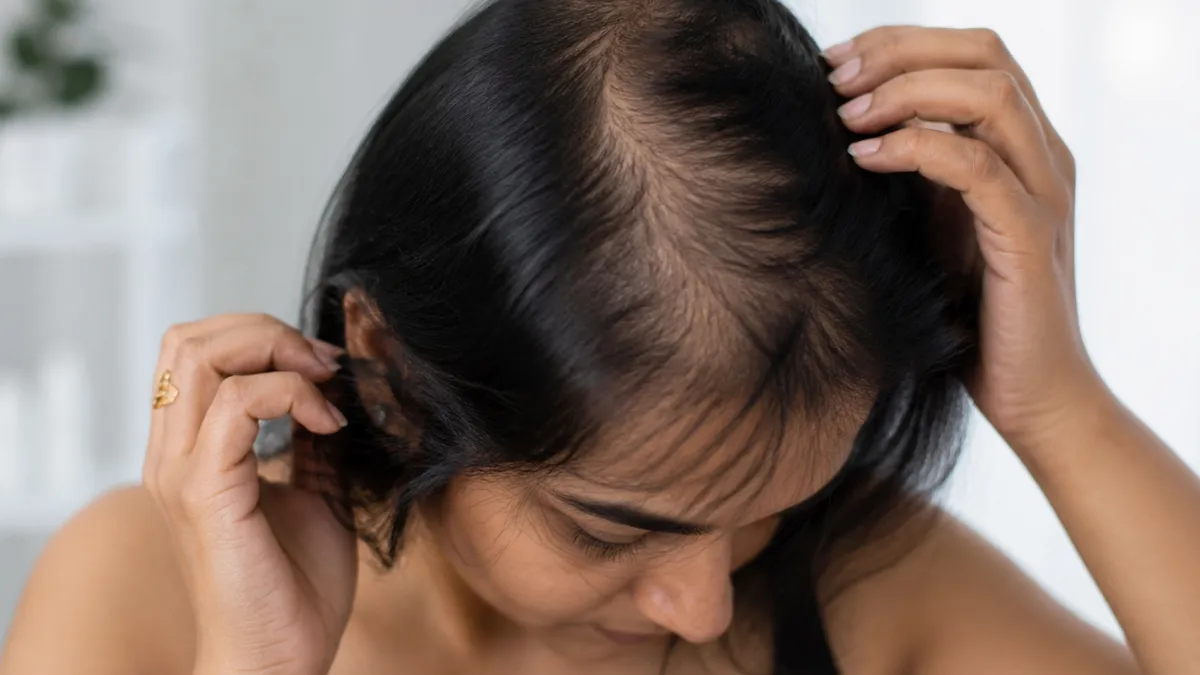 Hair Loss Treatment in Adyar: 6 Clinics That Deliver Results