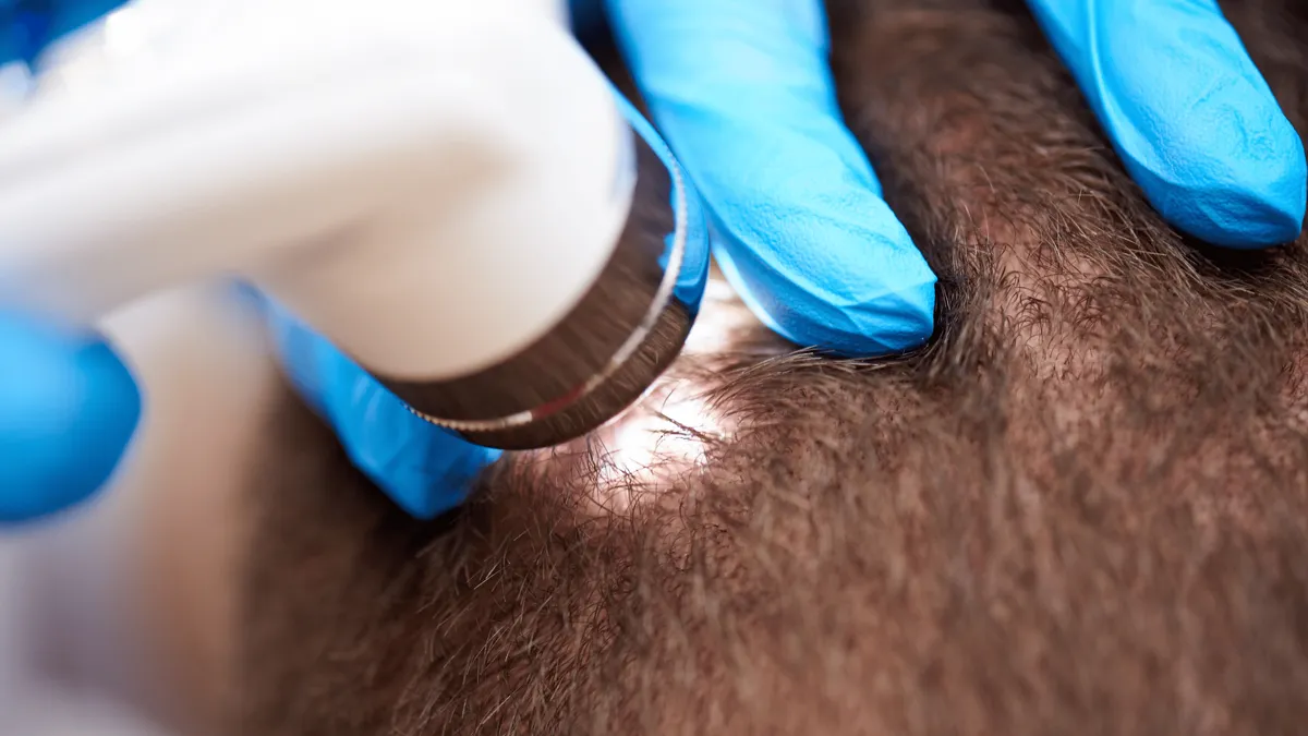 Hair Loss Treatment In Madambakkam: 5 Dermatology Clinics To Consider