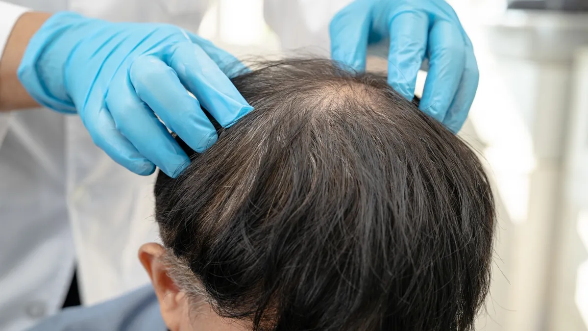 10 Trusted Hair Loss Treatment Clinics in Thazhambur (2026)