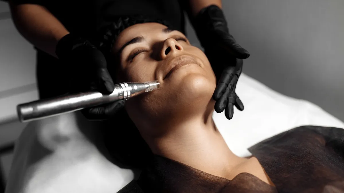 Laser Hair Removal in Vengaivasal: Costs, Benefits, and Top Clinics (2026 Guide)