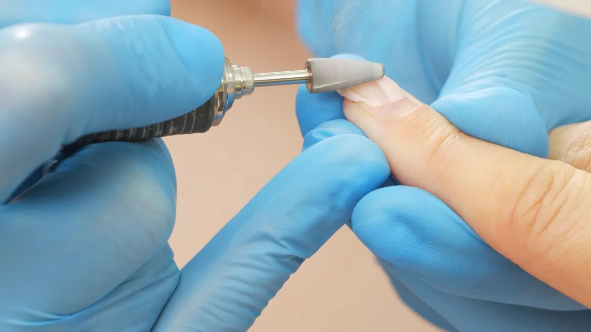 Top 10 Specialists for Best Nail Surgery Treatment in Chennai