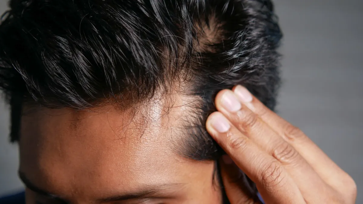 Can You Naturally Regrow Thinning Hair?