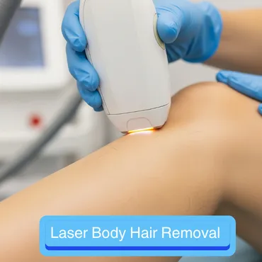 Laser Body Hair Removal